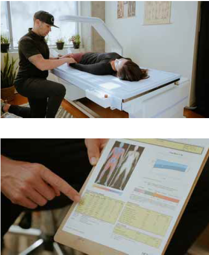 dexa scan image
